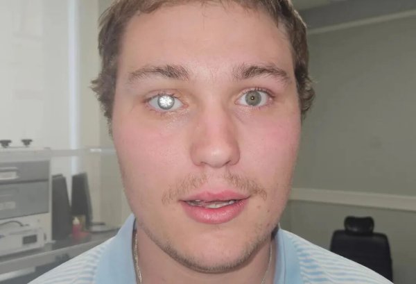 大圣策略 真·闪瞎眼！失明小哥用2克拉钻石打造闪亮义眼，200万美元挂脸上，真刺激...